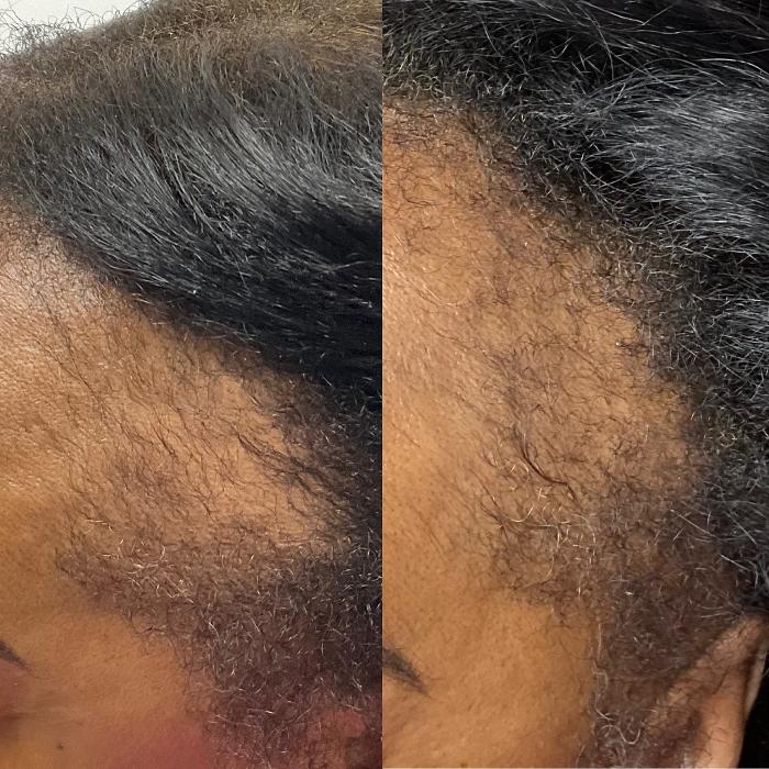 Buffalo Beauty Brows LLC - Buffalo, NY