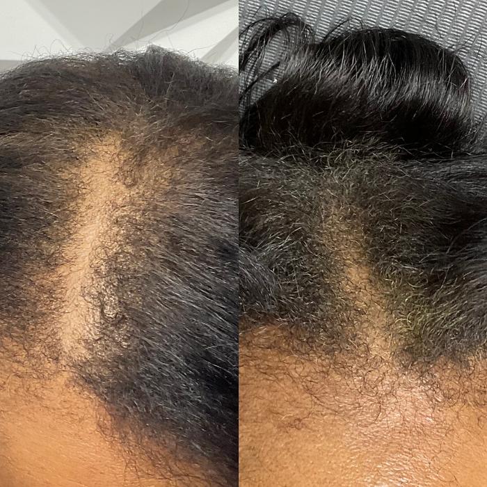 Buffalo Beauty Brows LLC - Buffalo, NY