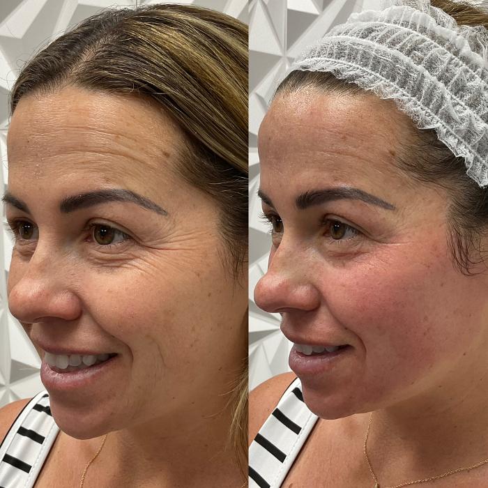 Buffalo Beauty Brows LLC - Buffalo, NY