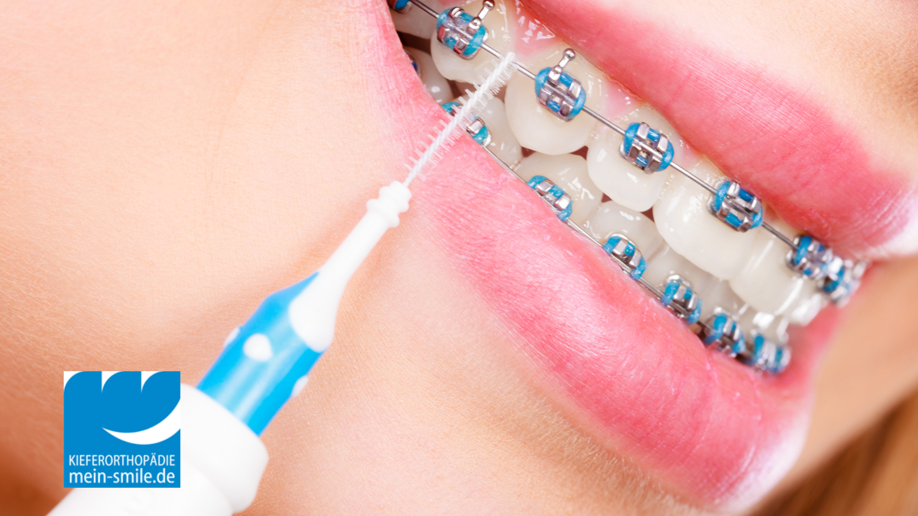 mein-smile Kieferorthopädie - Dr. Dirk Kujat MSc & Kollegen, Walther-Rathenau-Straße in Groß-Gerau