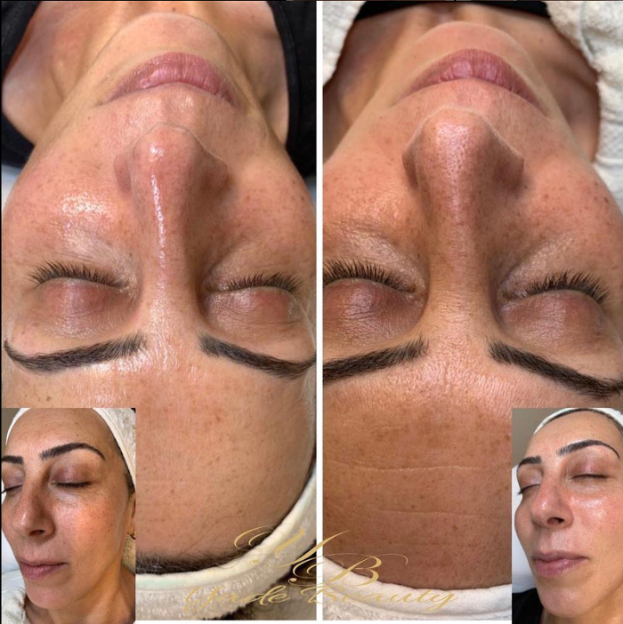 Yade Beauty Liestal in Liestal