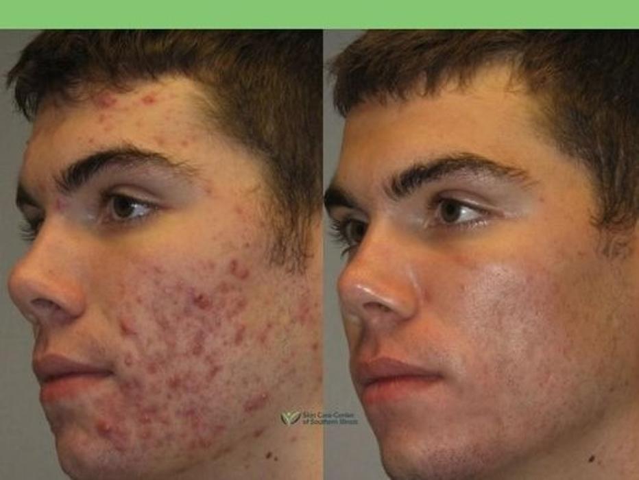 Schweiger Dermatology Group - Mt Vernon - Mount Vernon, IL
