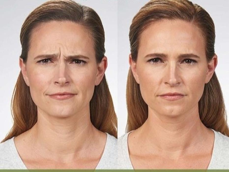 Schweiger Dermatology Group - Mt Vernon - Mount Vernon, IL