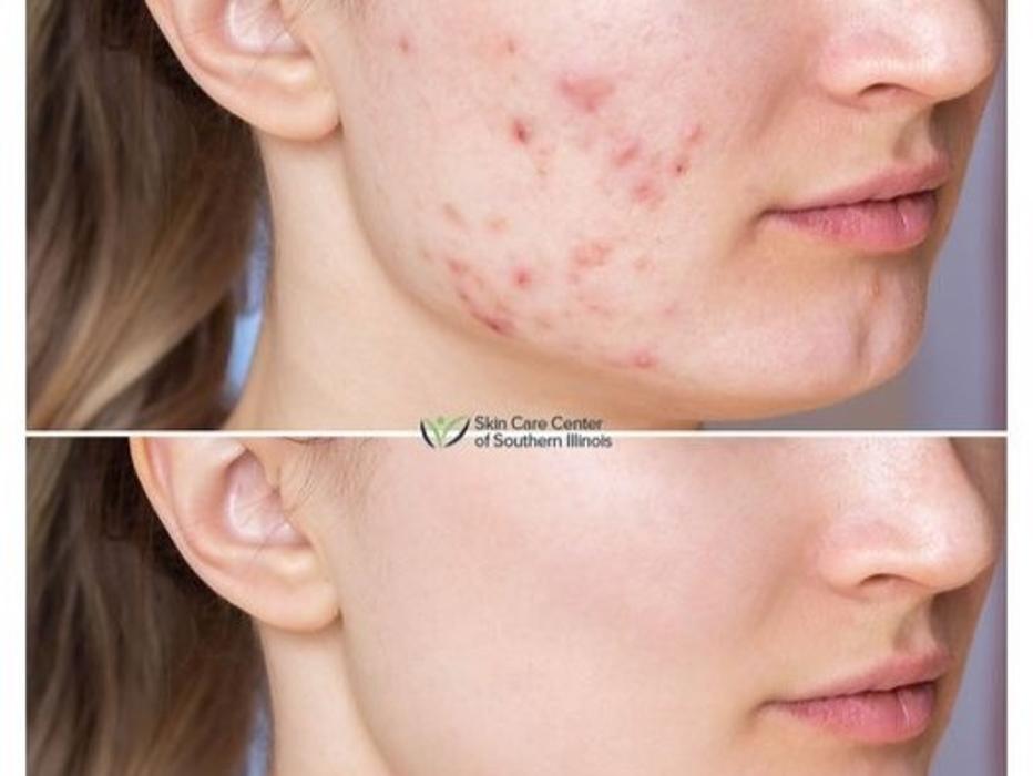 Schweiger Dermatology Group - Mt Vernon - Mount Vernon, IL