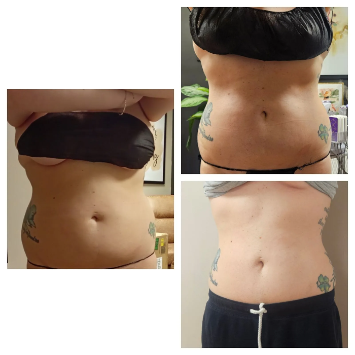 Effortless Body Solutions - New Bedford, MA