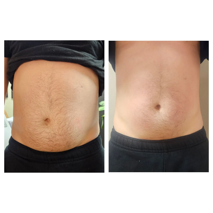 Effortless Body Solutions - New Bedford, MA