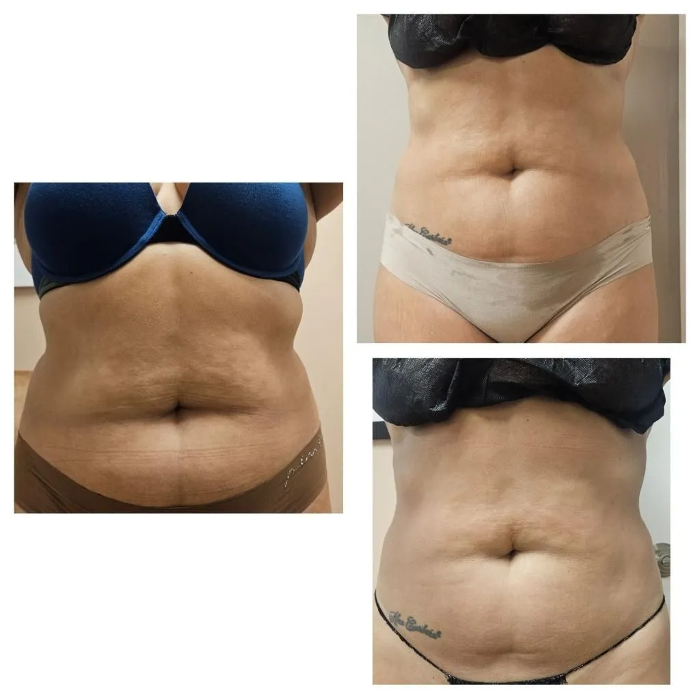 Effortless Body Solutions - New Bedford, MA