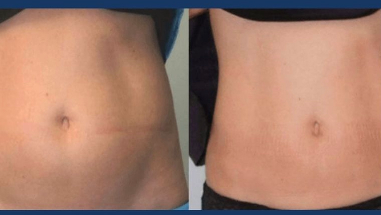 Finer Beauty Spa - Bronx, NY