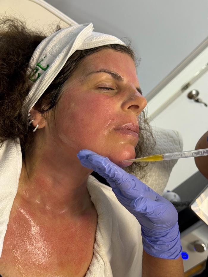 Cloud 17 Med Spa PC - Allentown, PA