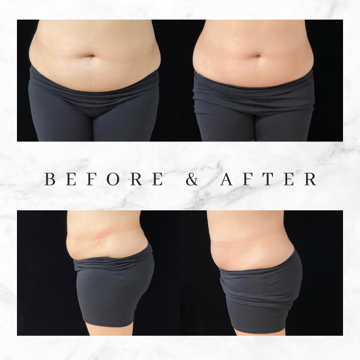 Cloud 17 Med Spa PC - Allentown, PA