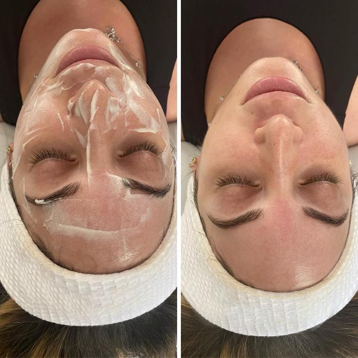 Cloud 17 Med Spa PC - Allentown, PA