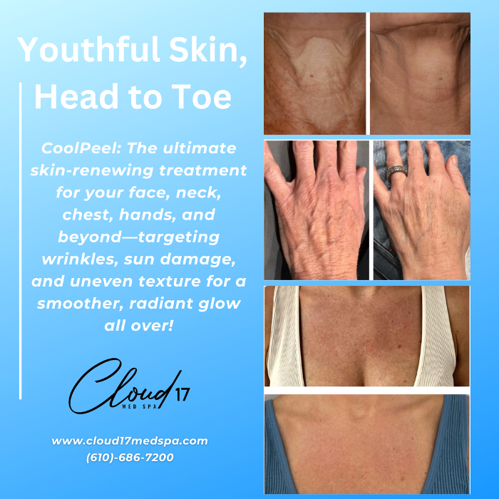 Cloud 17 Med Spa PC - Allentown, PA