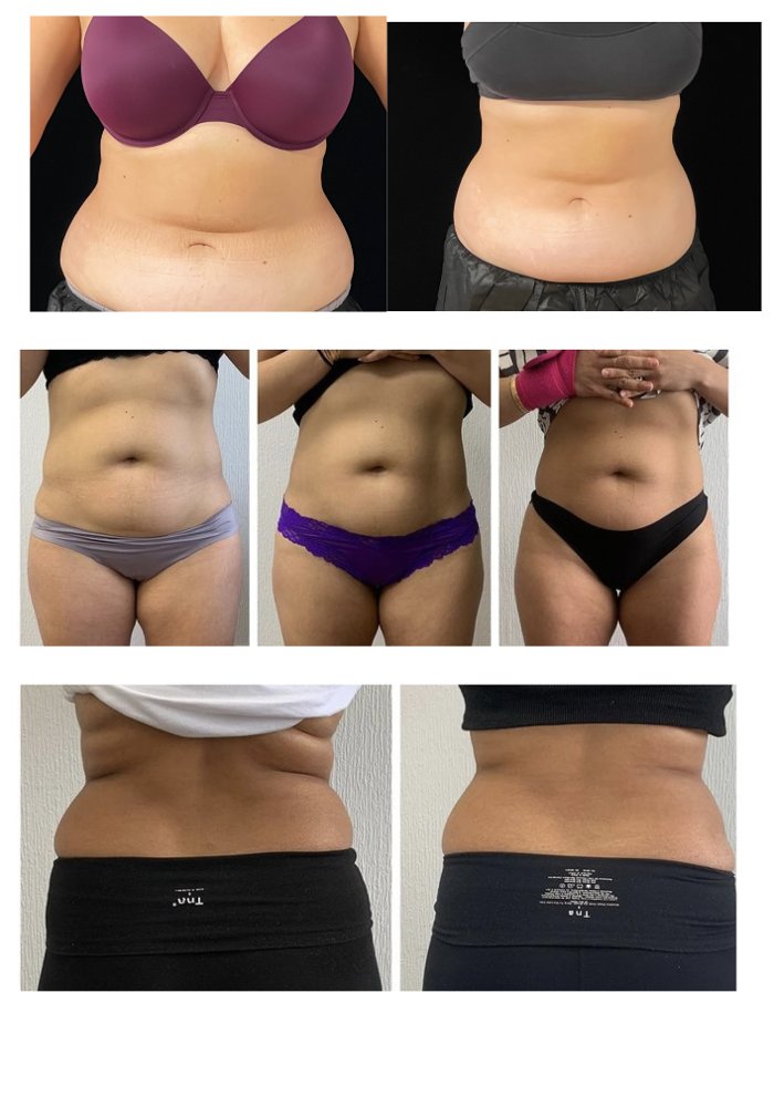 Cloud 17 Med Spa PC - Allentown, PA