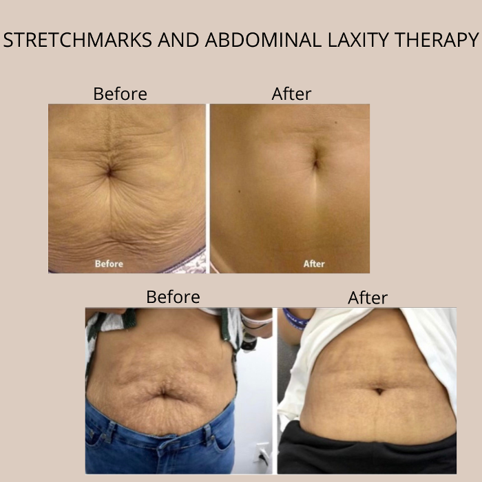 Cloud 17 Med Spa PC - Allentown, PA