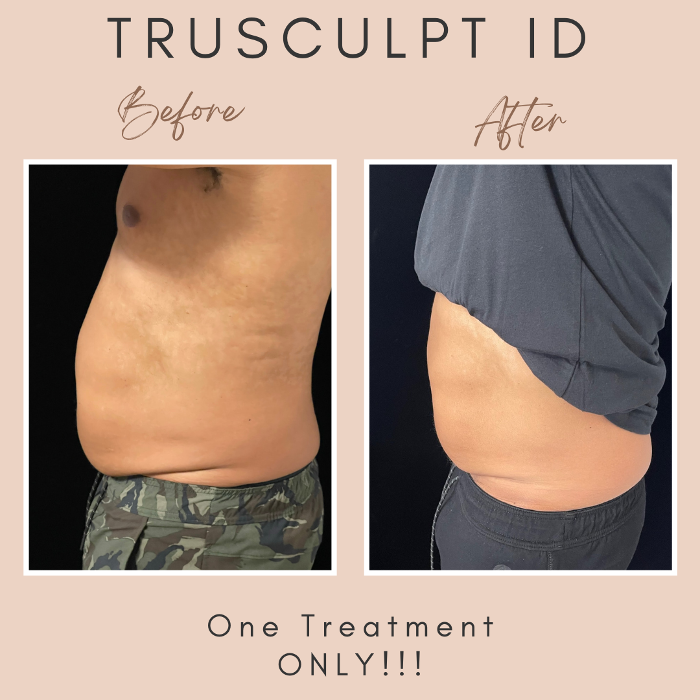 Cloud 17 Med Spa PC - Allentown, PA