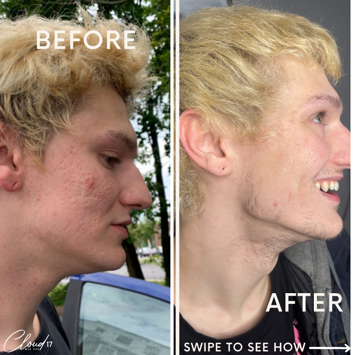 Cloud 17 Med Spa PC - Allentown, PA