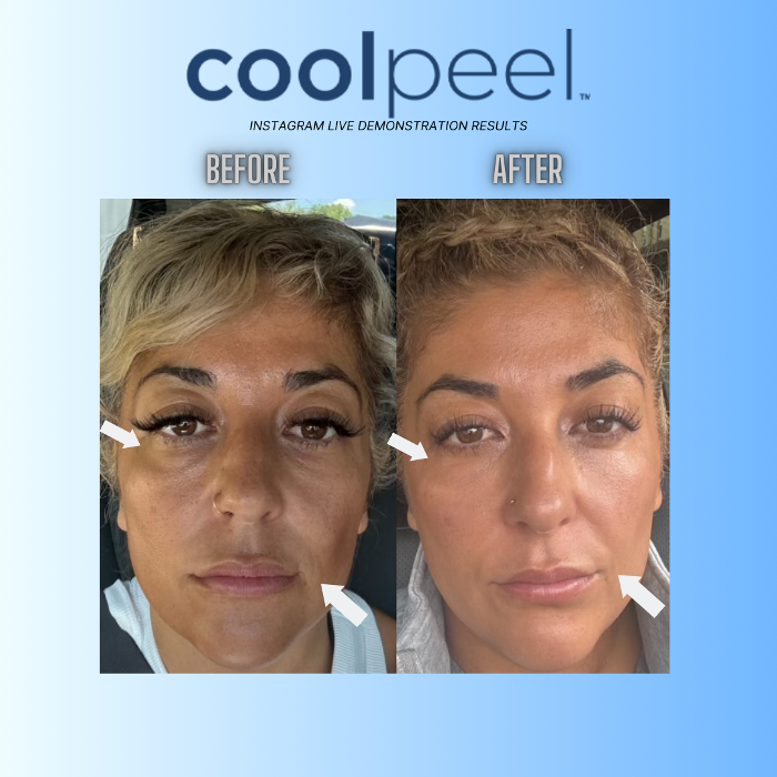 Cloud 17 Med Spa PC - Allentown, PA