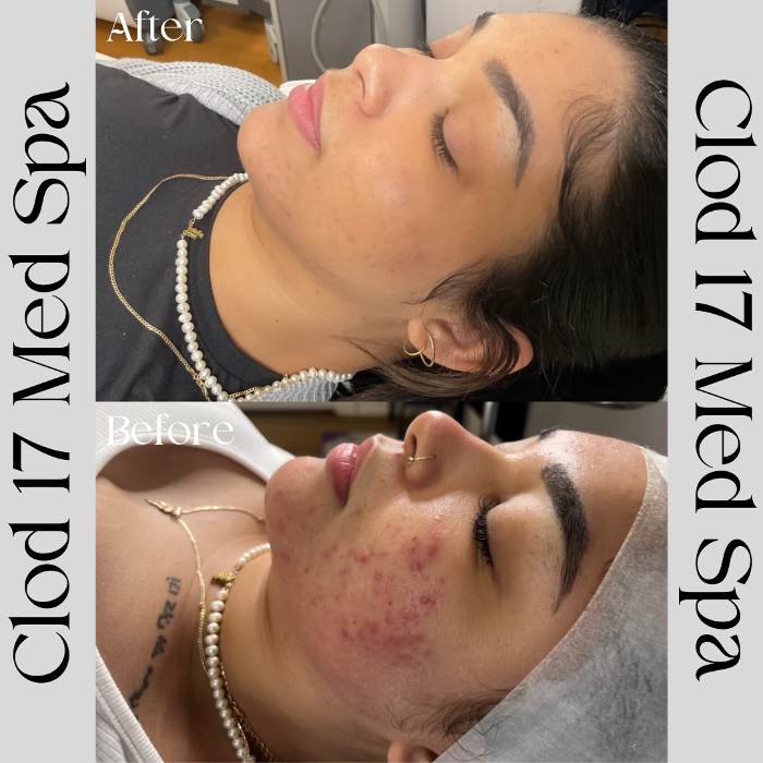 Cloud 17 Med Spa PC - Allentown, PA