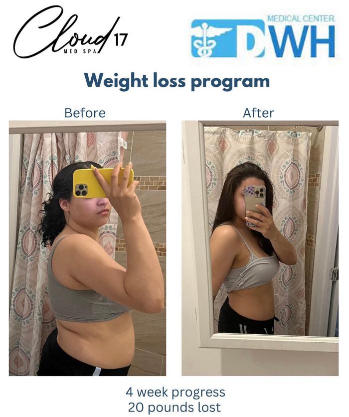 Cloud 17 Med Spa PC - Allentown, PA