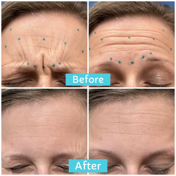 Ablaze Aesthetics - Union, KY