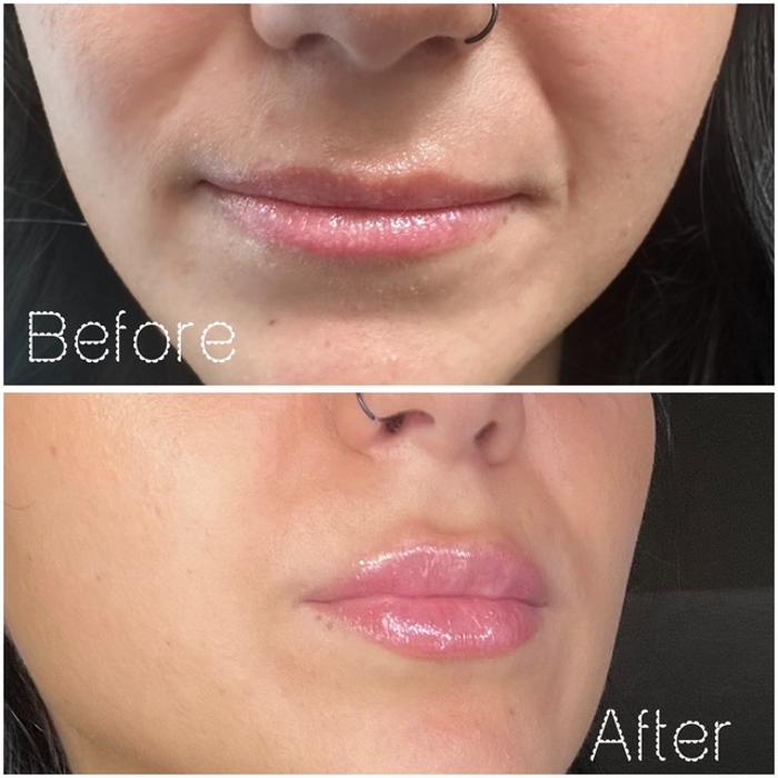 Ablaze Aesthetics - Union, KY