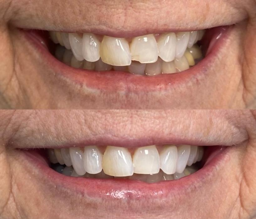 Green Valley Dental Center Image