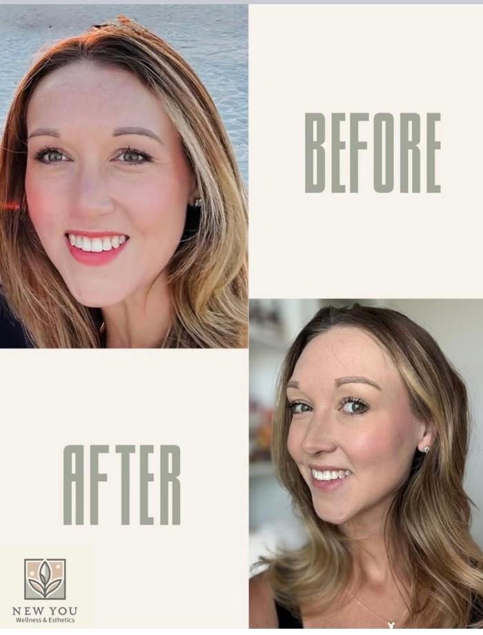 New You Wellness & Esthetics - Panama City, FL