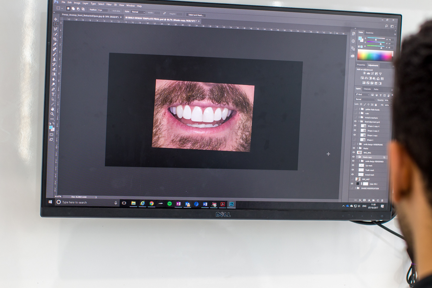 Gallery thumbnail