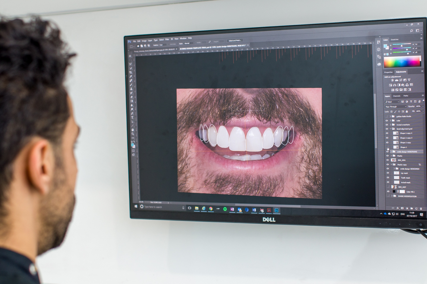 Gallery thumbnail