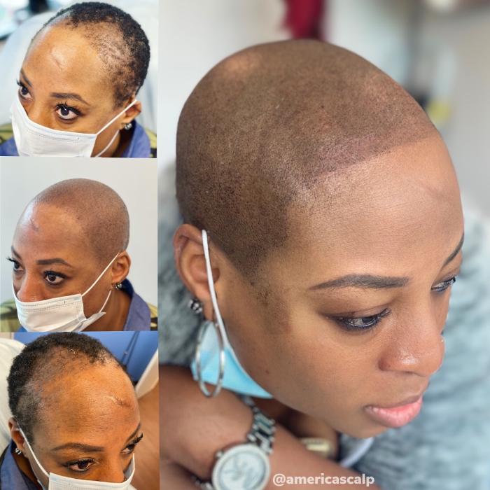 Hixson Hairlines - Chattanooga, TN