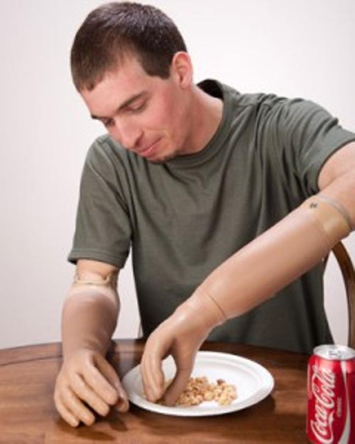 SRT Prosthetics & Orthotics - Muncie, IN