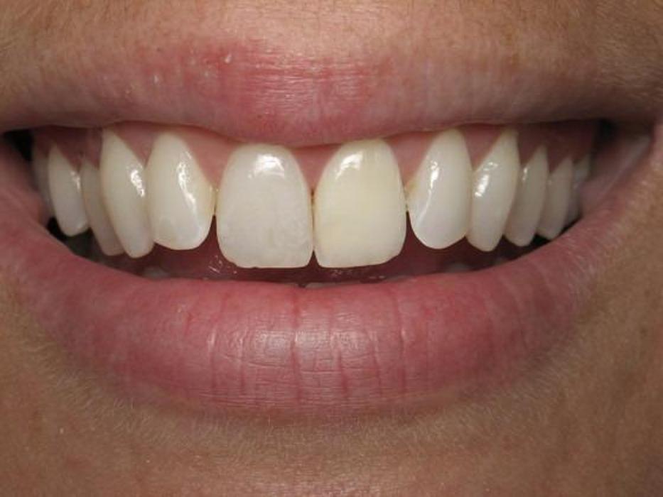 Dr Peter Gold: Peter D Gold, DDS - Schenectady, NY