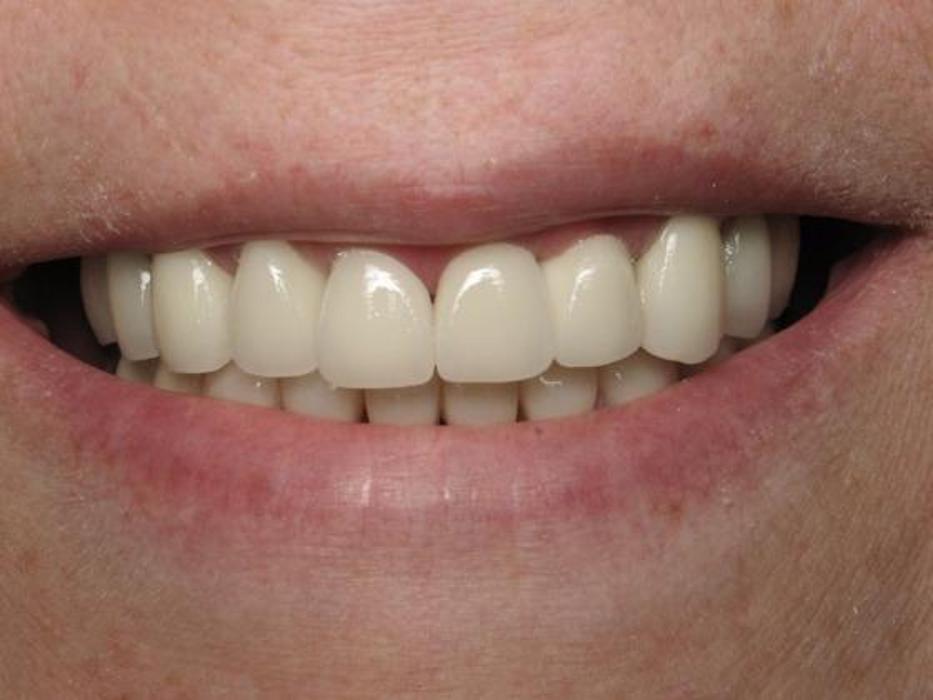 Dr Peter Gold: Peter D Gold, DDS - Schenectady, NY