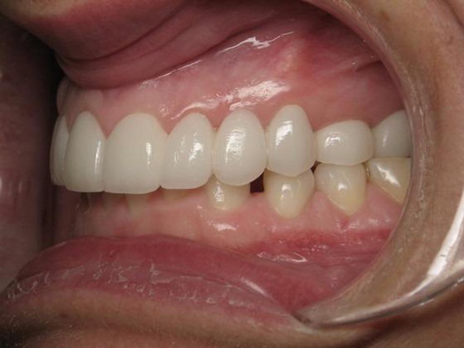 Dr Peter Gold: Peter D Gold, DDS - Schenectady, NY
