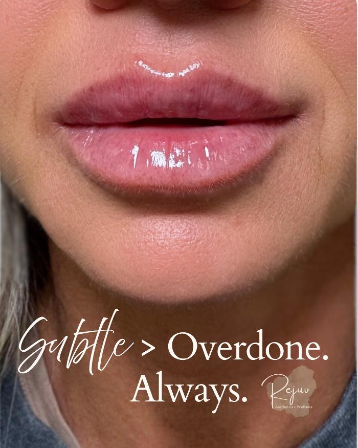 Rejuv Aesthetics + Wellness Medspa Image