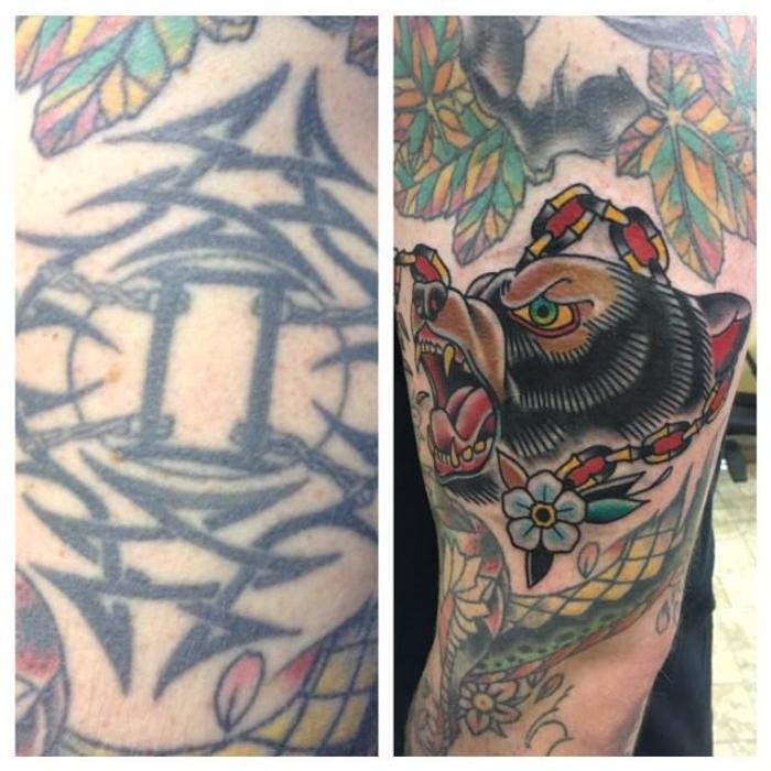 Removery Tattoo Removal & Fading - Framingham, MA