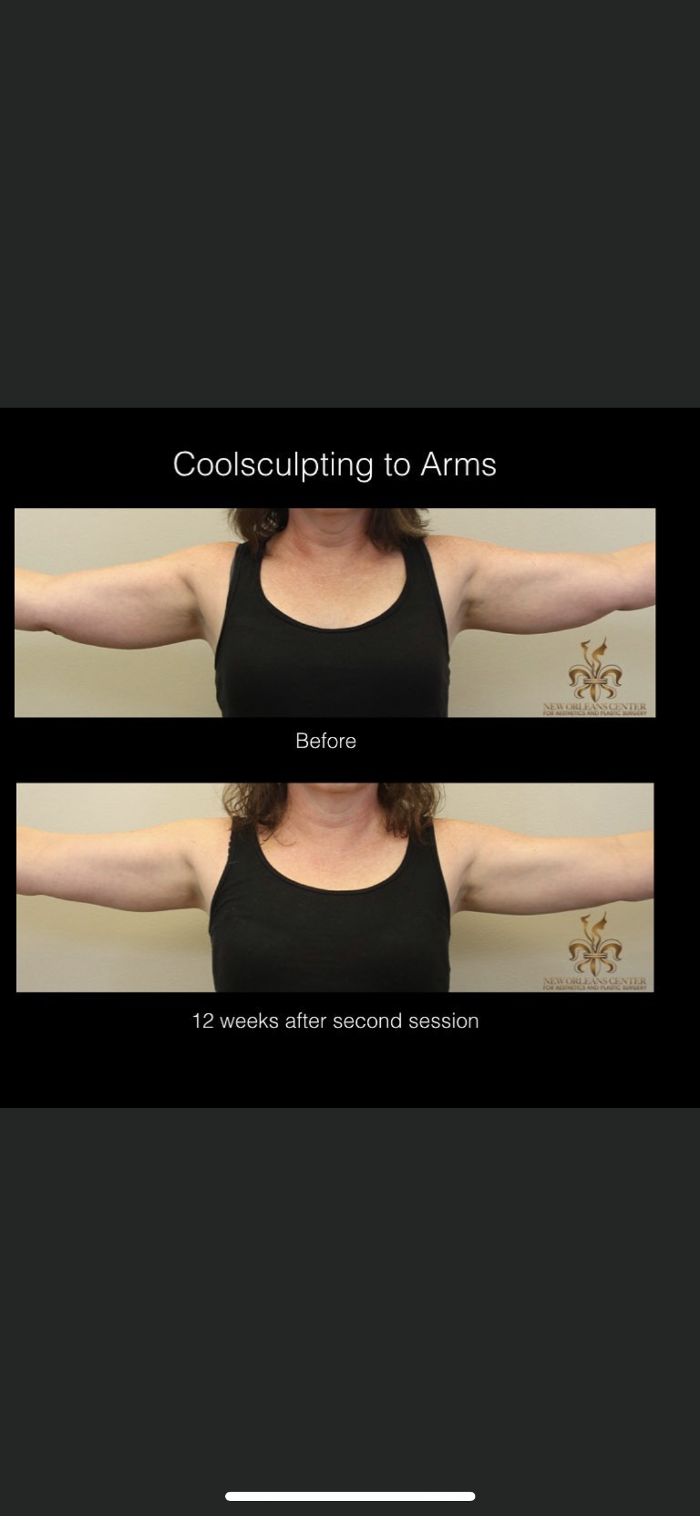 Elina Yushuvayev, MD - Bayside, NY