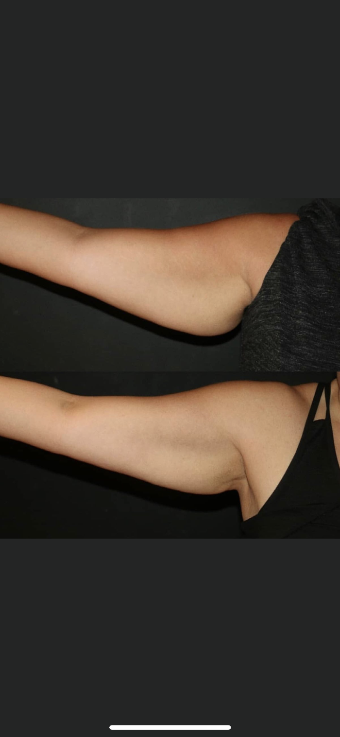 Elina Yushuvayev, MD - Bayside, NY