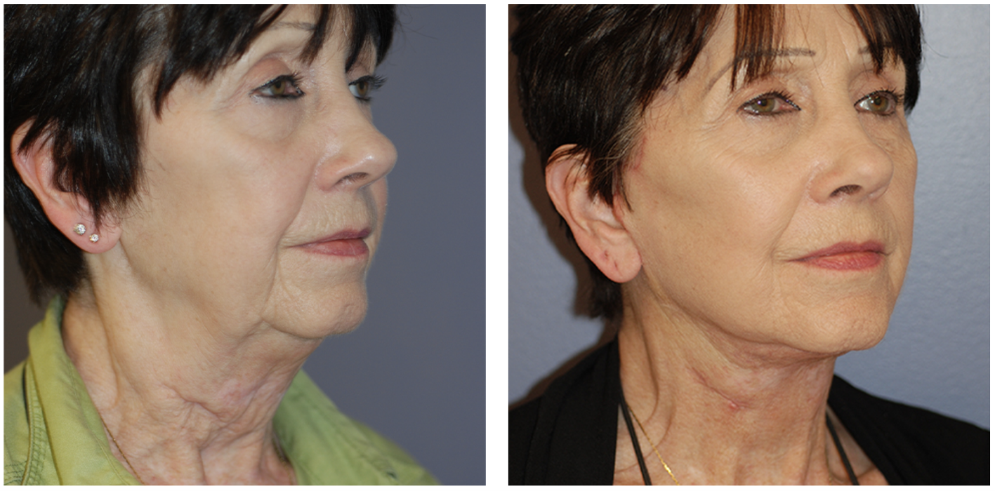 Ethos Plastic Surgery: Ginger Xu, M.D. Image