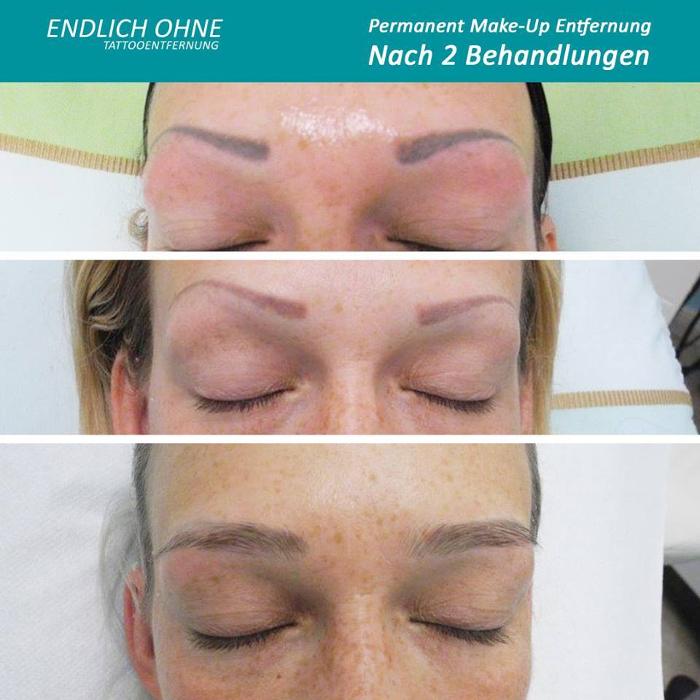 ENDLICH OHNE Tattooentfernung Filiale Leipzig, Magazingasse in Leipzig