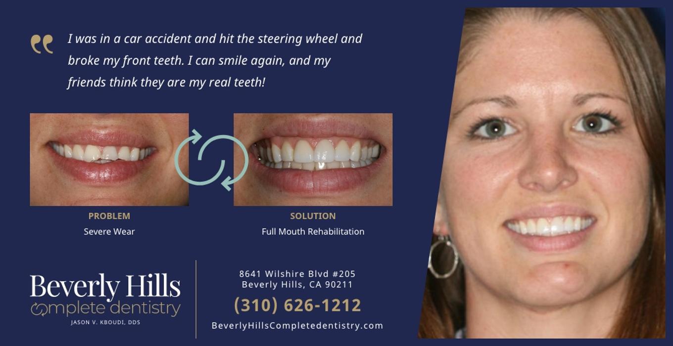 Beverly Hills Complete Dentistry Image