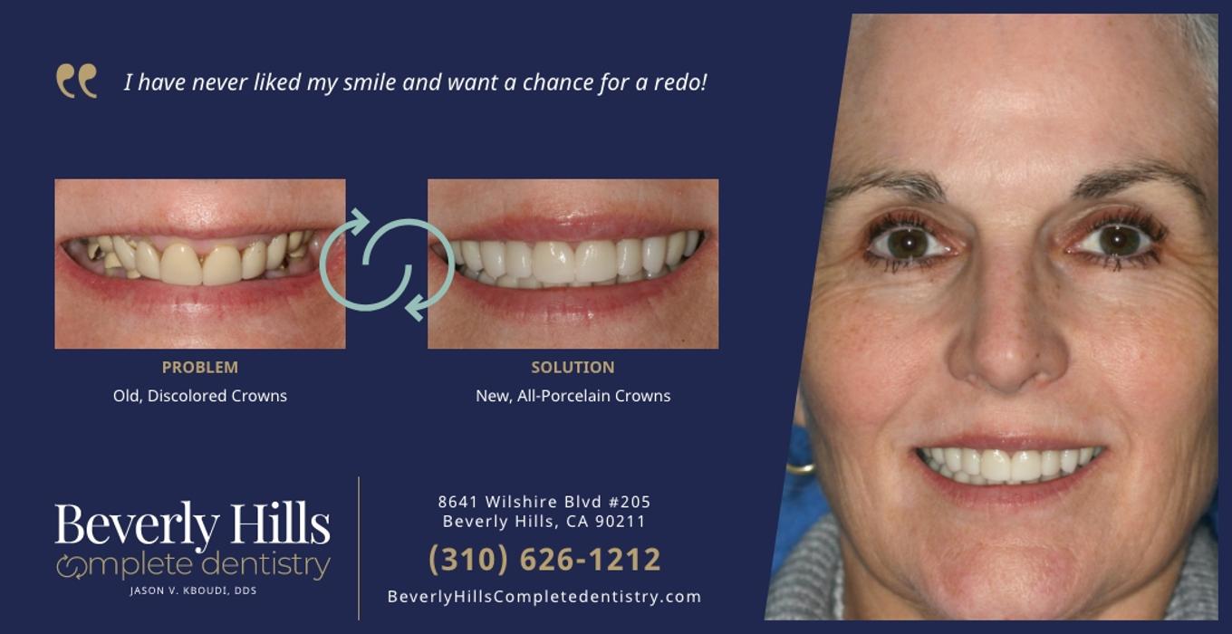 Beverly Hills Complete Dentistry Image