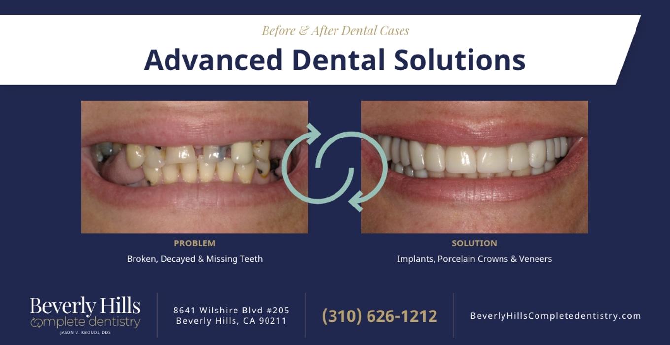 Beverly Hills Complete Dentistry Image