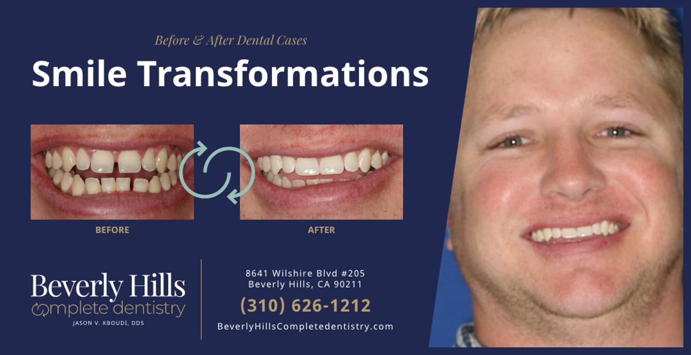 Beverly Hills Complete Dentistry Image
