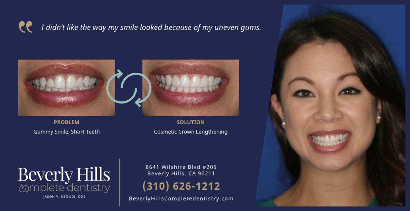 Beverly Hills Complete Dentistry Image