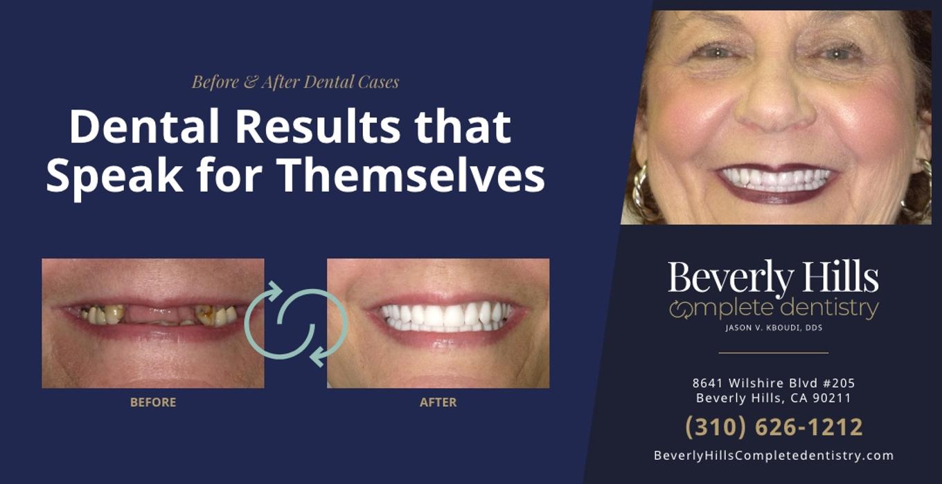 Beverly Hills Complete Dentistry Image