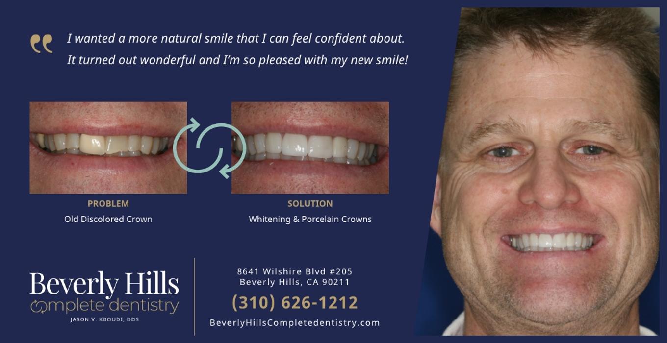 Beverly Hills Complete Dentistry Image