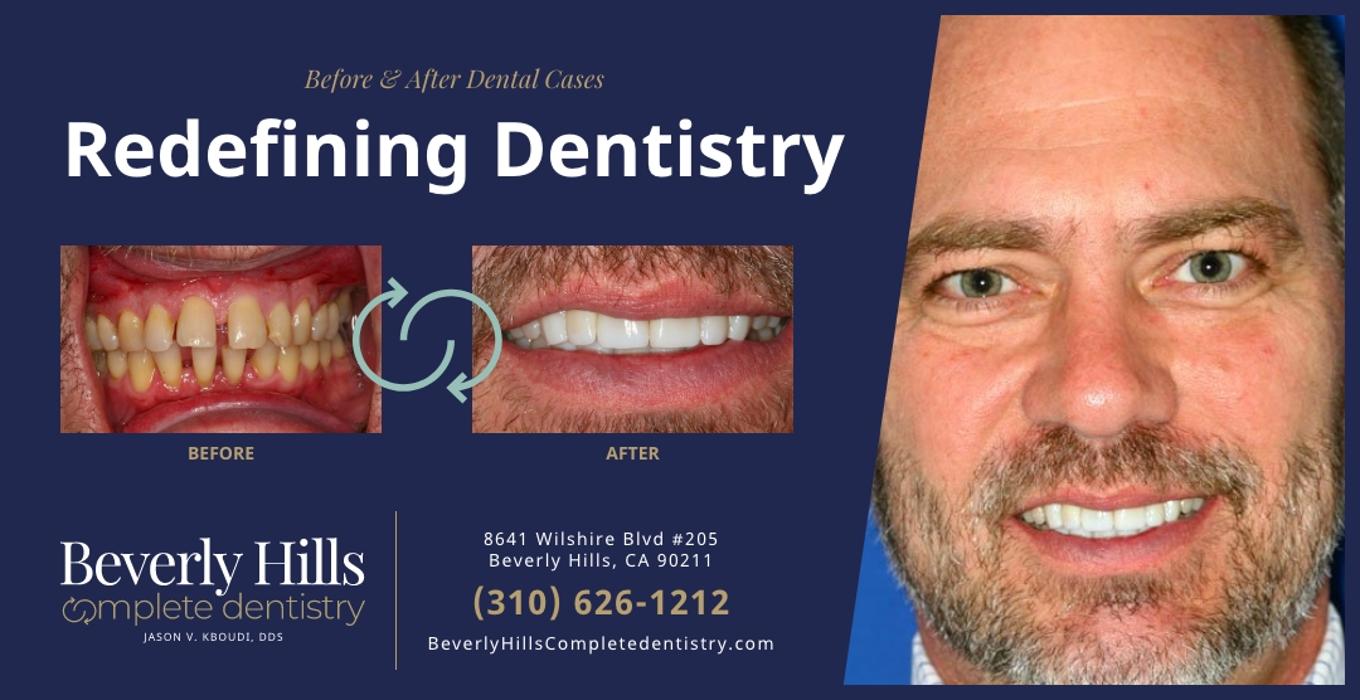 Beverly Hills Complete Dentistry Image