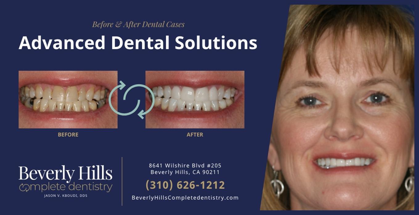 Beverly Hills Complete Dentistry Image
