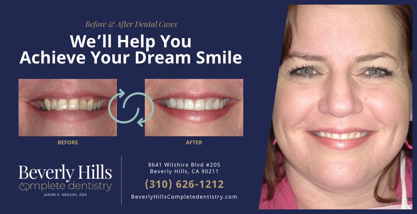 Beverly Hills Complete Dentistry Image